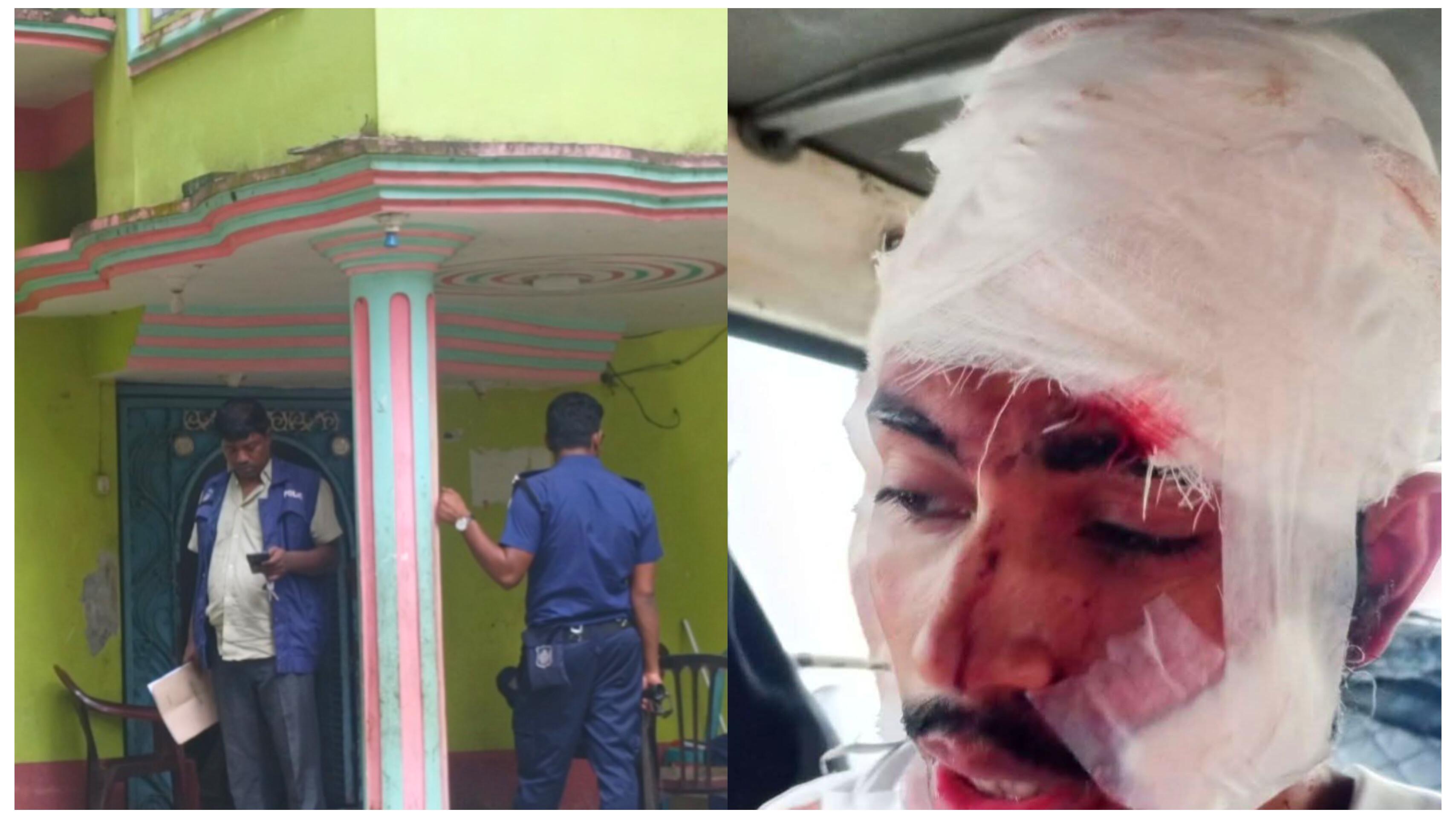 মাতামুহুরীতে দুর্ধর্ষ ডাকাতি, এলোপাতাড়ি ডাকাতের দায়ের কোপে গুরুত্বর আহত আহত-১
