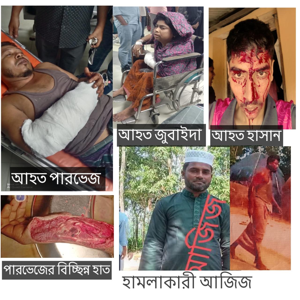 পেকুয়ায় পৈতৃক সম্পত্তি নিয়ে বিরোধ: হামলায় আহত ৪, জামাতার হাত বিচ্ছিন্ন